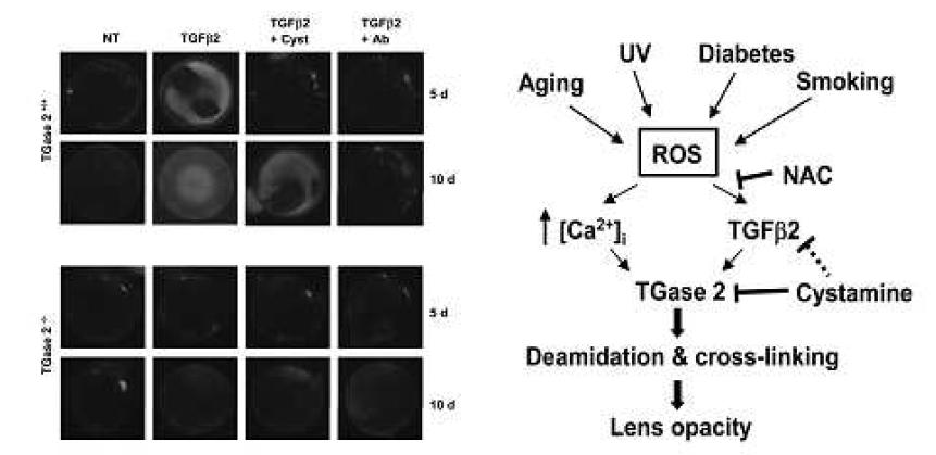 TGase 2 activation is crucial in TGFβ-induced cataract