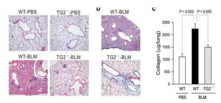 Bleomycin-induced lung fibrosis in wild type and TGase 2 knockoutmice