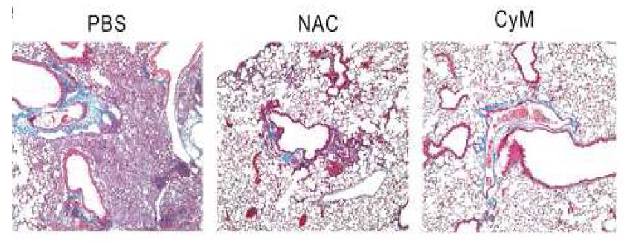 Effet of NAC or CyM treatment of bleomycin-induced lung fibrosis