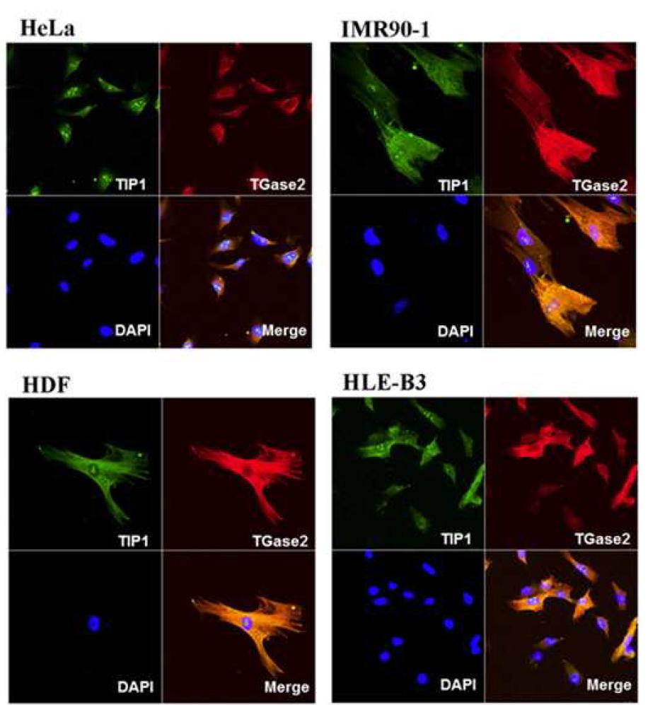 세포내 TIP1의 발현 양상 확인