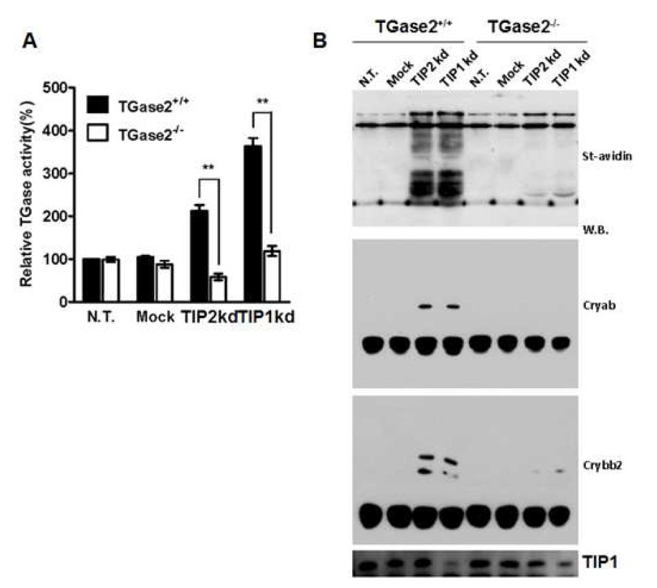 쥐 수정체 체외배양 백내장 모델에서 TGase2 활성에 대한 TIP1과 TIP2의 역할