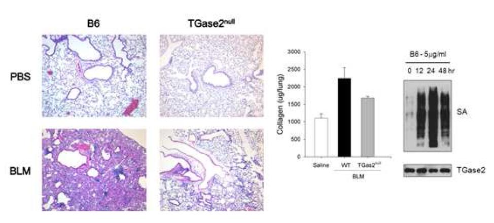 Reduced Bleomycin-induced Lung Fibrosis in TGase2-/- mice