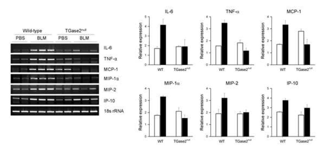 Inflammatory cytokines and chemokines were not pronounced during earlyphase of bleomycin-treatment in TGase2-/- mice