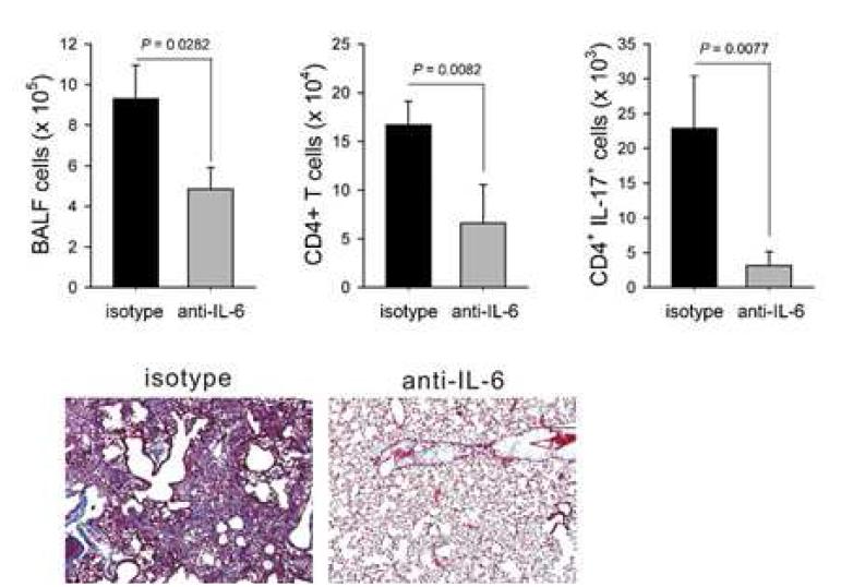 Block of IL-6 signaling through blocking antibody ameliorated BLM-induced lung inflammation and fibrosis