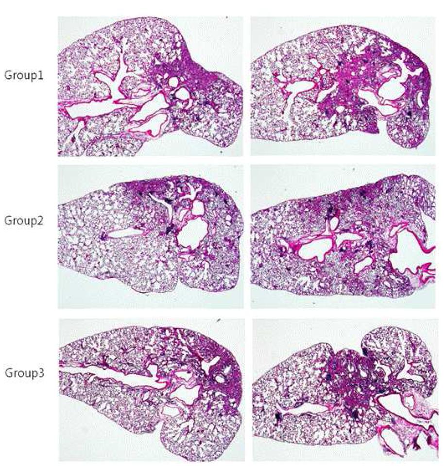 Bleomycin으로 유도한 특발성 폐섬유증을 유도한 동물모델의 폐 조직의 H&E staining 분석