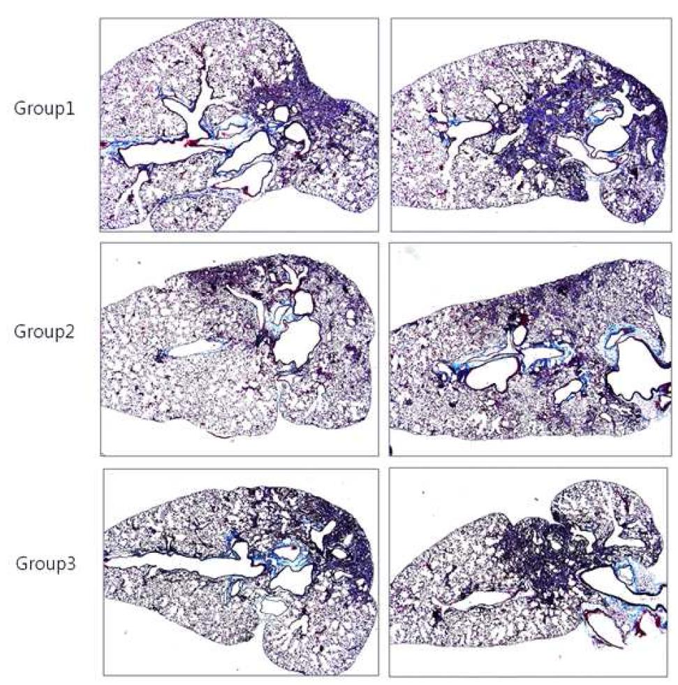 Bleomycin으로 유도한 특발성 폐섬유증을 유도한 동물모델의 폐 조직의 MT staining 분석