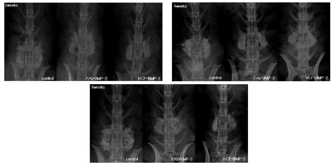 X-ray를 이용한 골형성능 확인