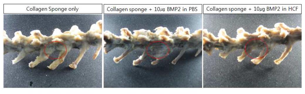 저농도의 BMP2 처리군에서의 척추 융합 양상 비교