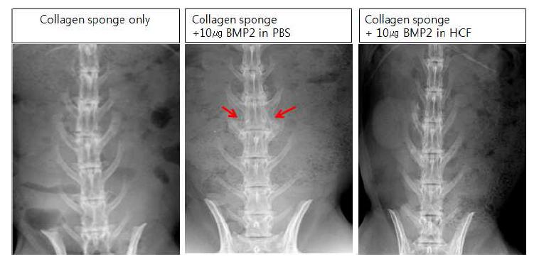 저농도의 골형성 단백질2 처리시 X-ray 분석 결과