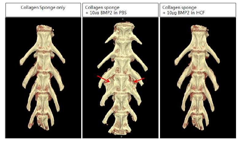 저농도의 골형성 단백질2 처리시 CT 분석 결과