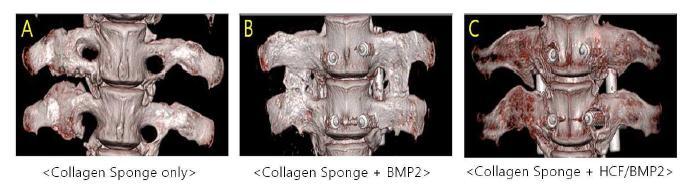 Micro- CT 분석 결과