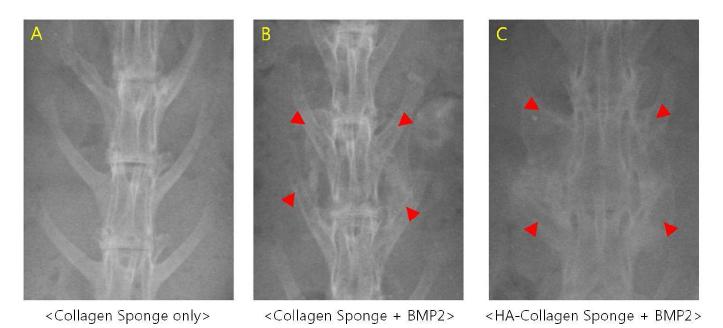 X-ray 분석 결과