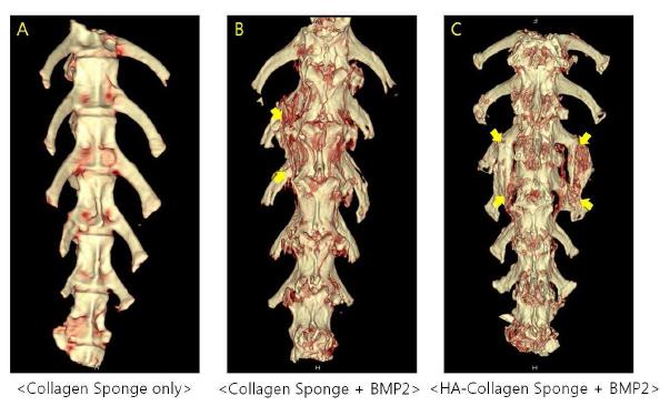 Micro-CT 분석 결과