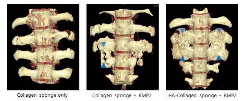 Micro- CT 분석결과