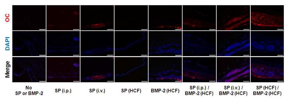 SP와 BMP-2의 전달방법에 따른 in vivo 상에서 HCF로 유입된 세포의 골세포로의 분 화. Mouse calvarial defect에 HCF를 이식하고 다양한 방법으로 SP와 BMP-2를 전달하고 8주 후 HCF를 중심으로 재생된 조직을 이용 골세포 표식자인 osteocalin (OC) 면역염색을 실시한 결과. 세포의 핵은 DAPI를 이용 염색하였음. Scale bar=100μm.