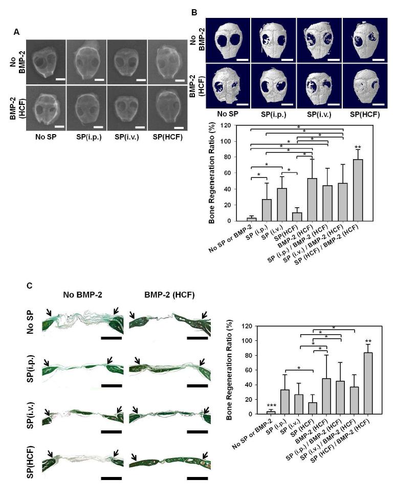 SP와 BMP-2의 전달방법에 따른 HCF를 중심으로 한 in vivo 골재생 평가 분석. Mouse calvarial defect에 HCF를 이식하고 다양한 방법으로 SP와 BMP-2를 전달하고 8주 후 HCF를 중심으로 하는 골재생을 평가 분석하였음.