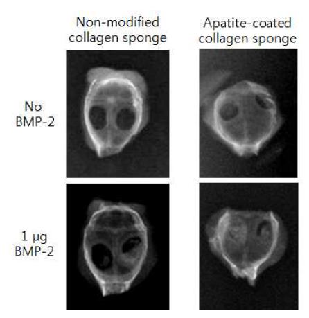 콜라젠 스폰지와 아파타이트가 코팅된 콜라젠 스폰지를 이용하여 BMP- 2를 마우스두개골 결손부위에 전달하여 재생된 뼈. X- ray 사진. 2개월.