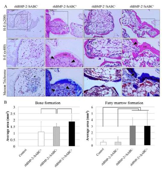 rhBMP-2/hSBC의in vivo bone formation