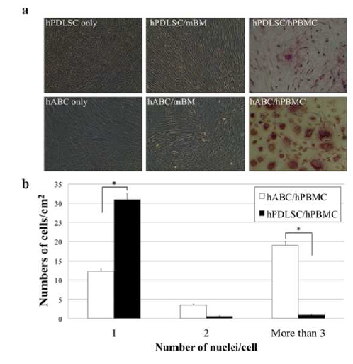 hPDLSC와 hABC의 파골 세포분화