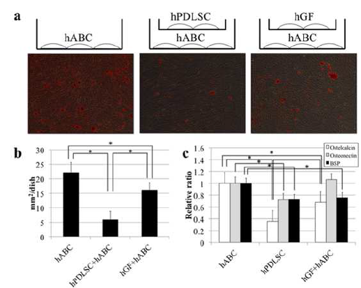 hABC의 골성 분화에 미치는hPDLSC의 효과