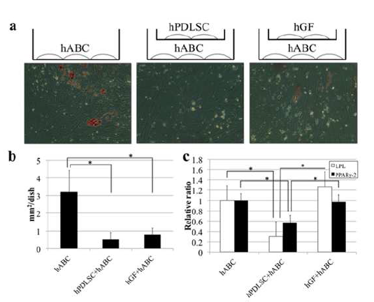 hABC의 지방 분화에 미치는hPDLSC의 효과
