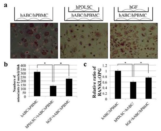hABC의 파골세포 형성에 미치는hPDLSC의 효과