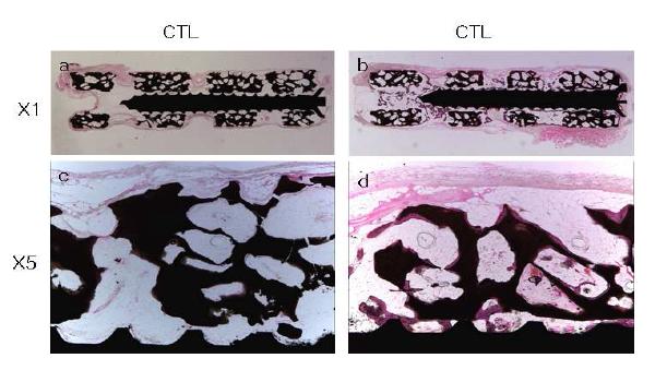 ectopic osteointegration(저배율)