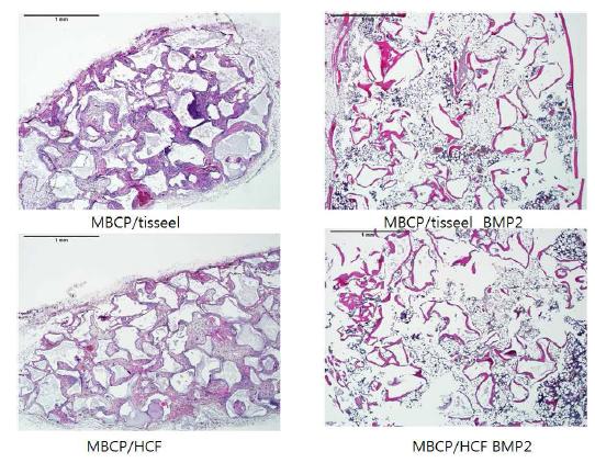 MBCP/Tiseel carrier에 의한 BMP-2의 ectopic bone formation