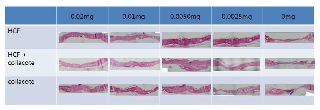 rat calvarial defect model 연구에서의 조직학적 결과. HCF와 collacote는 두군 모두 우수한 골재생을 유도하였으 나 HCF군에서 보다 적은 농도에서 우수한 골 재생이 확인되었음.