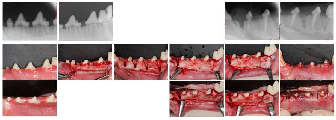 Dog alveolar bone defect model을 이용한 BMP/HA-collagen system의 골재생 효과 및 Extraction socket remodeling 분 석 실험 과정. 기종의 발치와 모델을 변형하여 buccal plate를 삭제하여 dehiscence type의 extraction socket을 형성하였고 실험군 별로 이식하였음. 잔존 치근은 신경 치료를 하여 잔존시킴으로써 조직학적 분석을 용이하게 하였음.