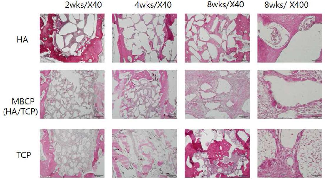 Dog alveola bone defect model에서 서로 다른 성질의 carrier에 의한 발치와 healing pattern. 8주후 소견에서 HA 이식 군에서 보다 많은 양의 골 재생이 이루어졌고 발치와의 dimension 유지가 양호한 것을 확인함.