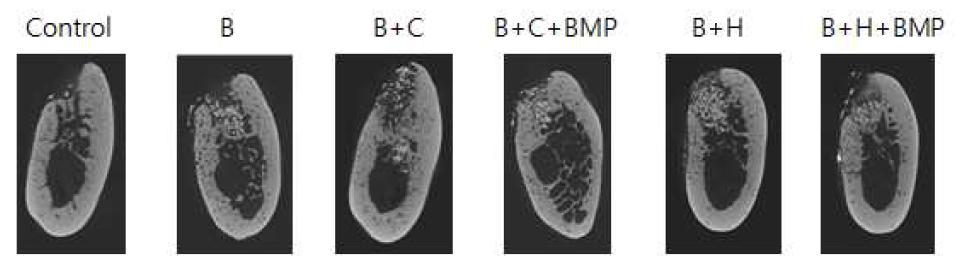 micro CT분성에의한 치조골 형태의 유지/재생을 분석하였음. BMP/HA시스템에의한 골 재생량이 가장 큰 것을 확인할 수 있음.