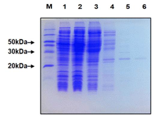 과발현 후 정제한 LCN2 단백질 확인 결과
