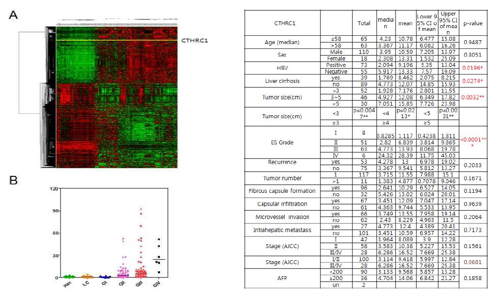 간세포암에서 CTHRC1 mRNA 발현 증가