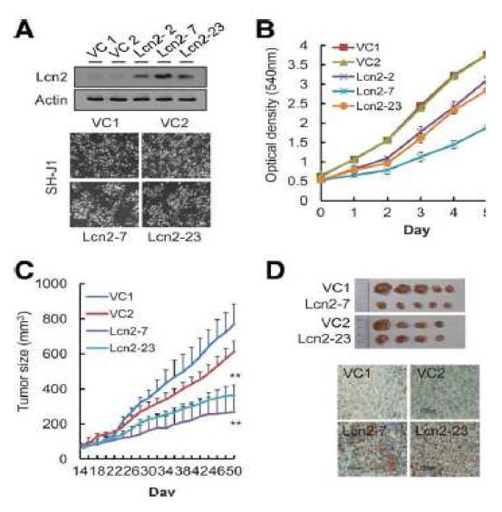 LCN2 발현에 의한 세포 성장 및 발암 억제