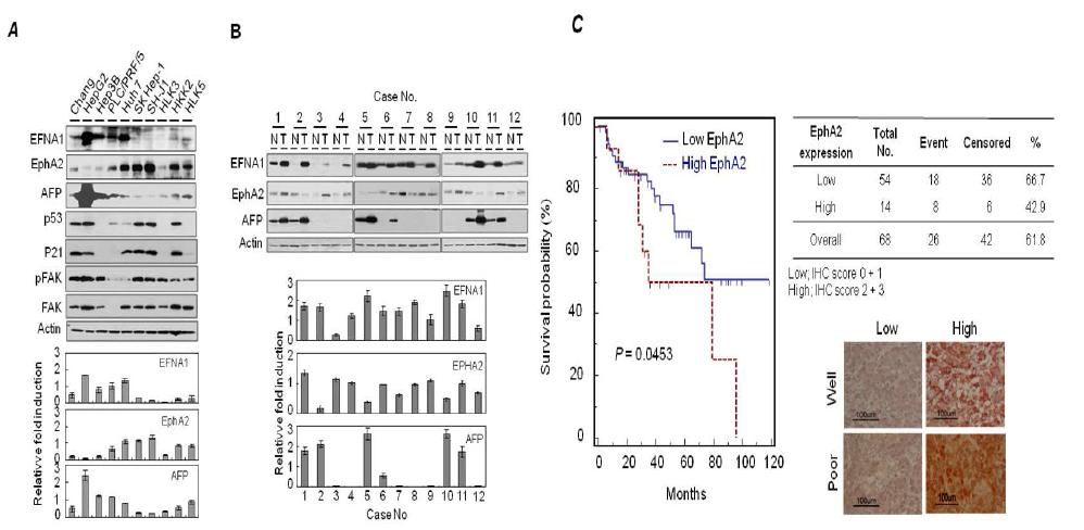 간암세포주와 감암환자 조직에서 EFNA1 및 EPHA2의 발현을 혈청의 Immunoblot Analysis를 통한 단백질 발현 확인 결과.