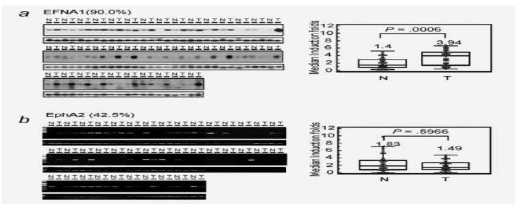 The levels of EFNA1 and EphA2 mRNA expression in HCC tissues.