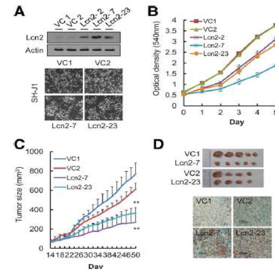 LCN2 발현에 의한 세포 성장 및 발암 억제