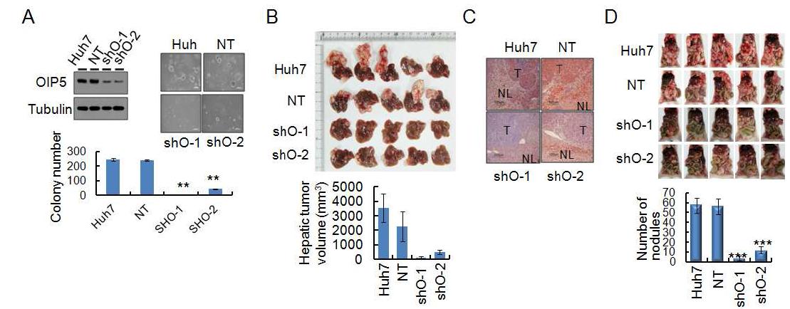 OIP5 knockdown에 의한 암 종괴 형성 및 전이 억제
