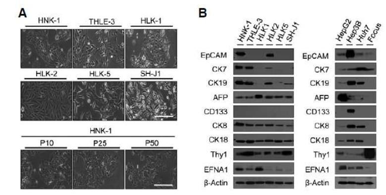 HNK1, THLE3와 간세포암 세포주의 모양과 HPC 마커 발현
