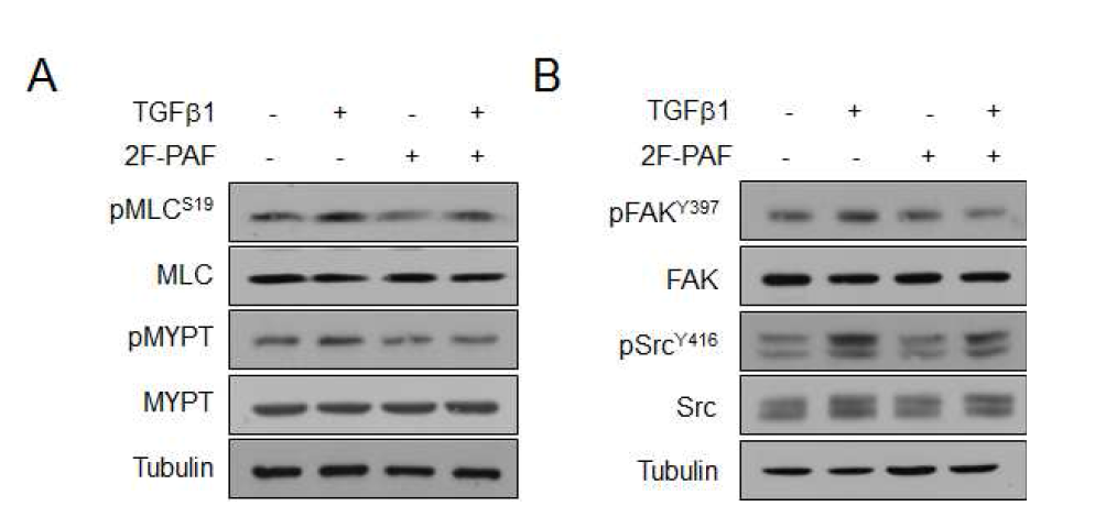 Fucosyltransferase 억제에 따른 세포 이동기전 확인.