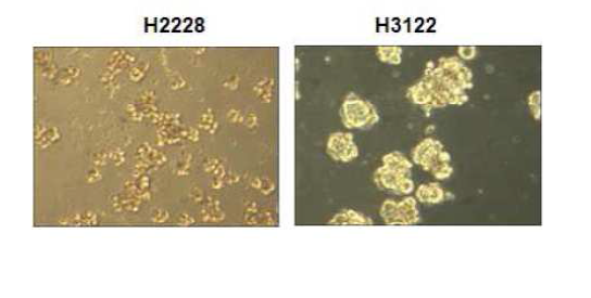 EML4- ALK 유전자 양성 세포주에서 시험관내 종양 형성능 확인