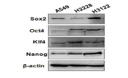 EML4- ALK 유전자 양성 세포주에서 줄기 세포인자 발현확인.