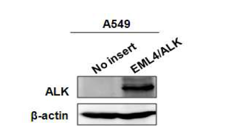 레트로바이러스 시스템을 이용하여 A549/EML4/ALK 세포주 제작