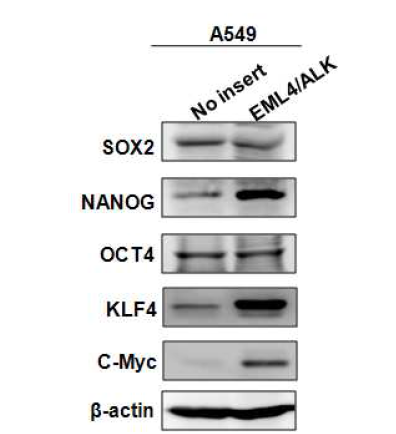 EML4/ALK 과발현된 세포주에서 줄기세포인자 발현 확인.