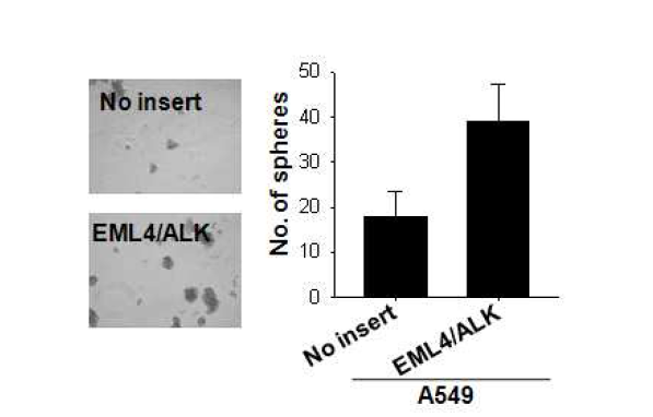 EML4/ALK 과발현에 따른 시험관내 종양형성능 증가.