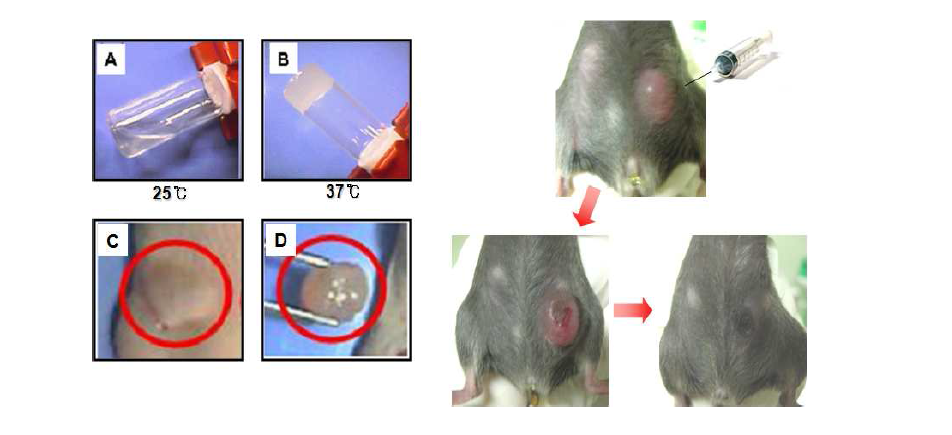 생체 내 저해제 전달용 키토산 하이드로젤 시스템을 이용한 항암효과
