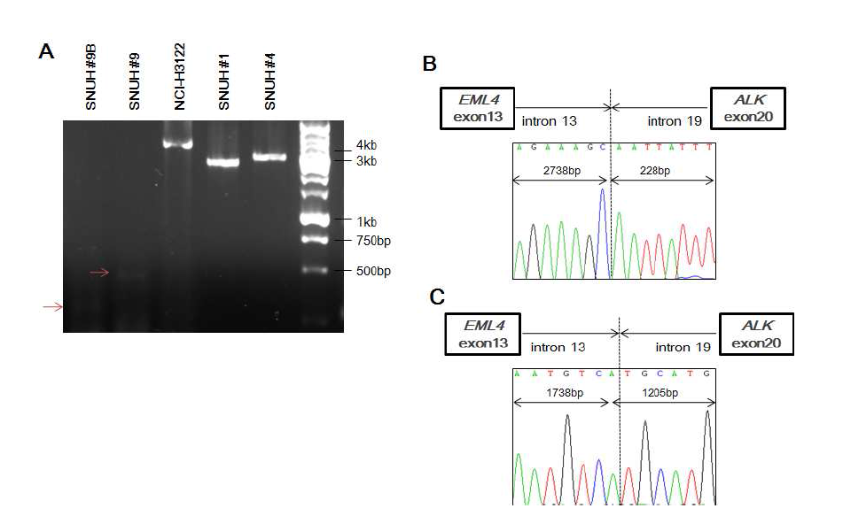 genomic EML4- ALK fusion의 확인.