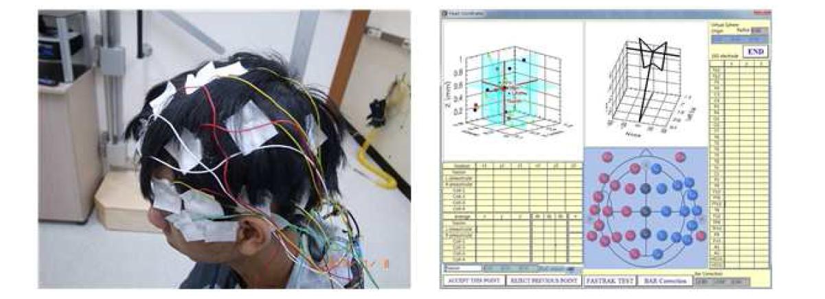 뇌파 전극과 마커 코일을 부착한 모습(좌). 머리 좌표계 측정 프로그램(우)