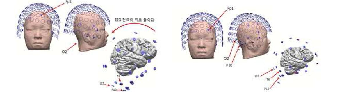 EEG 전극의 위치를 표준 위치에 표시했을 때와 실제 위치에 표시한 예.